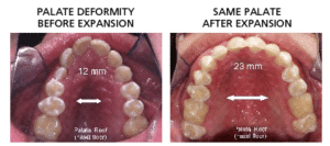 tmj specialist