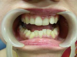 tmj dentist